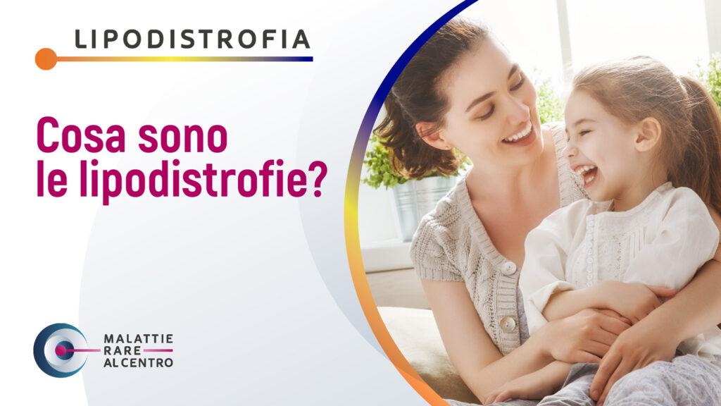 Cosa sono le lipodistrofie