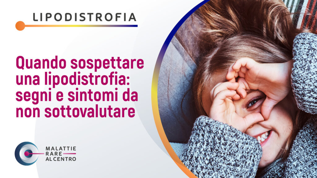 Quando sospettare una lipodistrofia: segni e sintomi da non sottovalutare