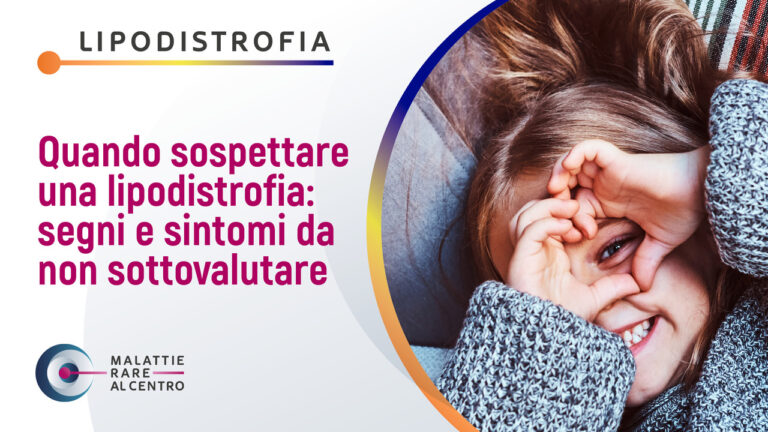 Quando sospettare una lipodistrofia: segni e sintomi da non sottovalutare