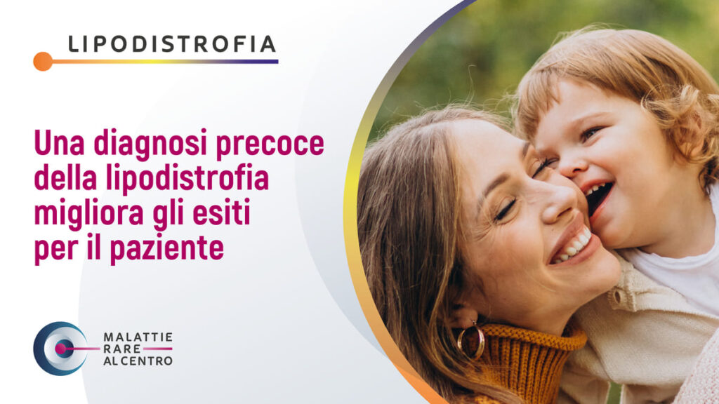 Lipodistrofia: importanza di una diagnosi precoce